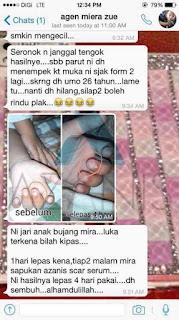 azanis scar serum testimoni review