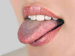 நாக்கில் உள்ள மச்ச பலன்:Naakil ulla machathin palan mole in tongue macha palangal female