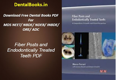 Fiber Posts and Endodontically Treated Teeth PDF