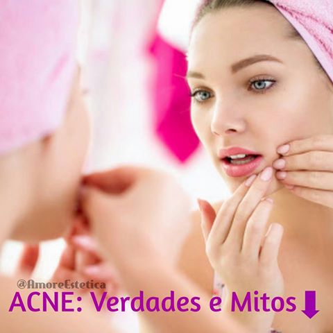 Mitos e Verdades sobre a temida ACNE