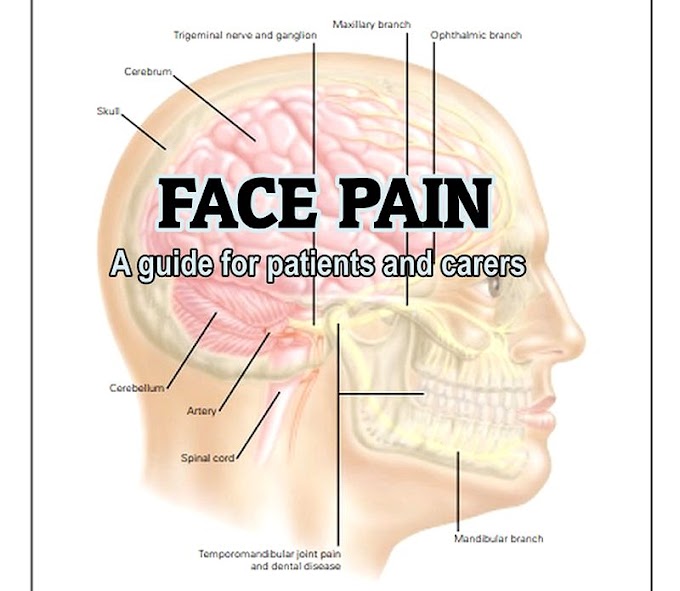 PDF: Face Pain - A guide for patients and carers