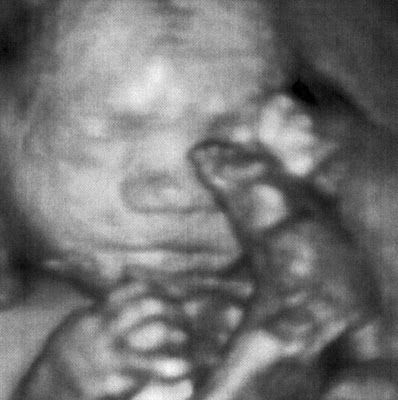 3d ultrasound 20 weeks boy. Logan#39;s 3D Ultrasound
