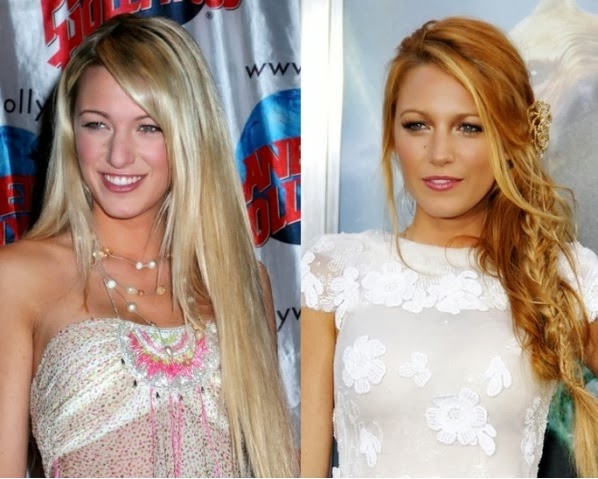 http://photofun4u.com/celebs-with-cosmetic-surgery