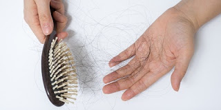 Ayurvedic Treatment for Hair Loss or Hair Fall