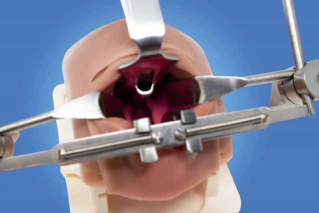 First and only Bilateral Cleft Lip and Palate Simulator from Smile Train's Simulare Medical | Benteuno.com