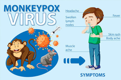 gejala awal cacar monyet, demam, batuk, pilek, nyeri otot