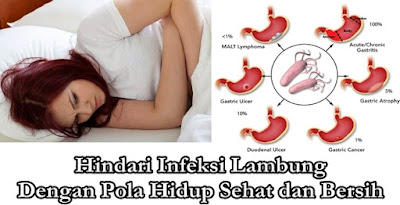 Obat Herbal Infeksi Lambung