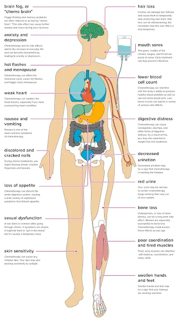 Chemotherapy side effefcts