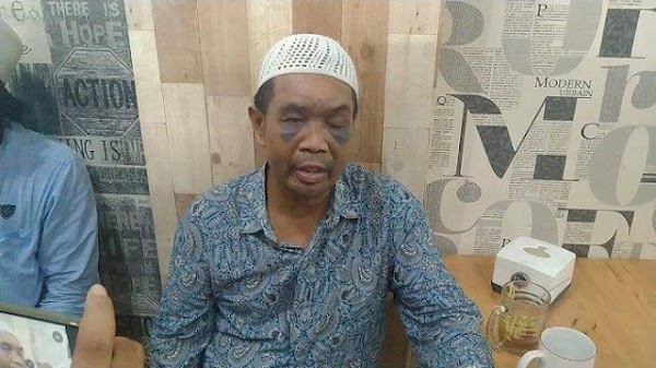 Habis Digebuki, Diinjak dan Disiksa Polisi, Kuli Bangunan Sarpan Disetrum 
