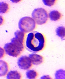 Granulocito neutrófilo en banda. Estas son una de las células progenitoras de los neutrófilos maduros que pueden conseguirse en el torrente sanguíneo, especialmente en situaciones de neutrofilia