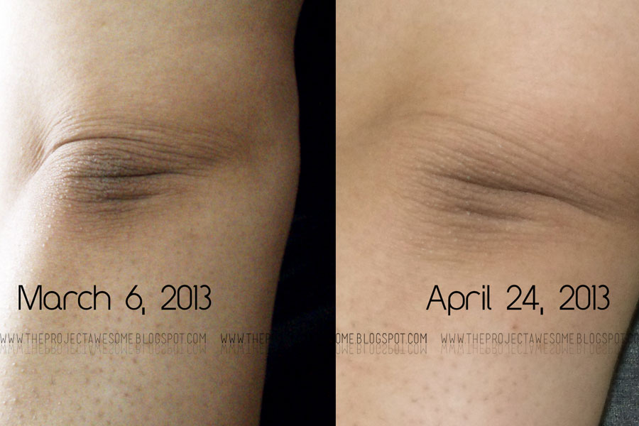 How To Lighten Dark Elbows Underarms And Knees Apps Directories