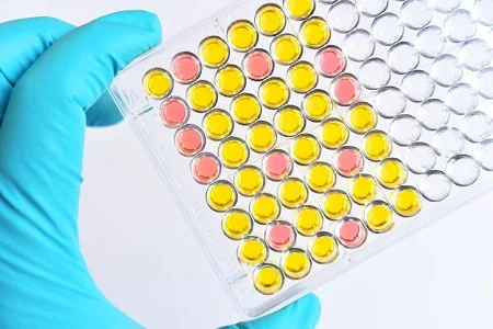 What is enzyme immunoassay