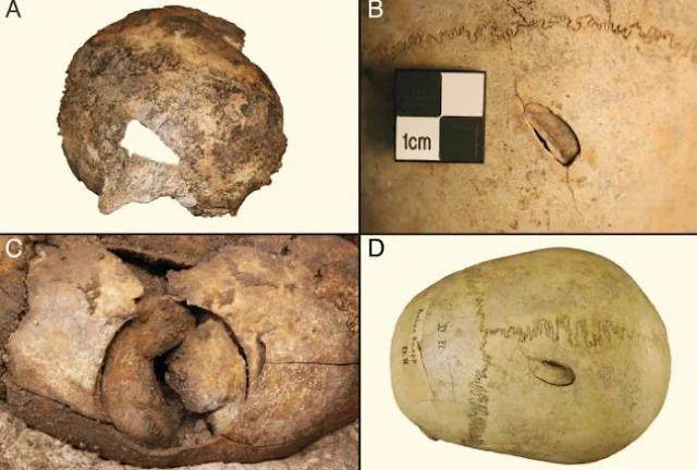 Estos cráneos de la era neolítica muestran heridas de guerra