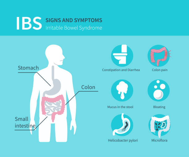 Irritable-bowel-syndrome