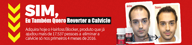 Como Acabar com a Calvície