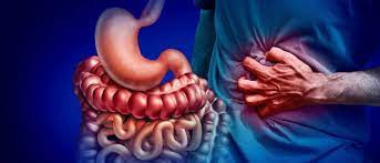 Understanding Crohn's Disease: A Comprehensive Overview