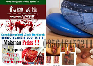 Beli Obat AmbeJoss & Krim Wasir Online