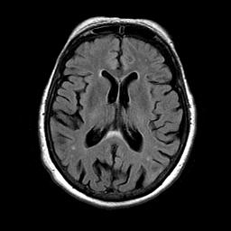 Brain Radiology
