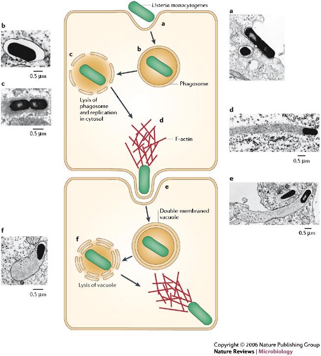 listeria