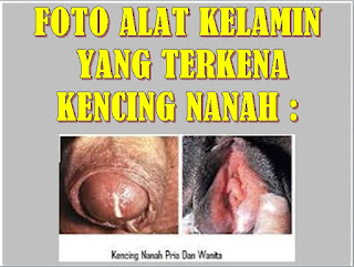 Obat Kencing Nanah Dari Tumbuhan Herbal