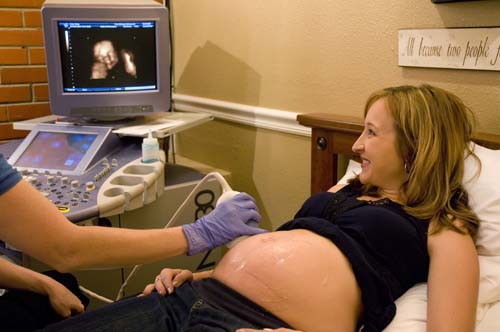 3d Ultrasound Pregnancy7