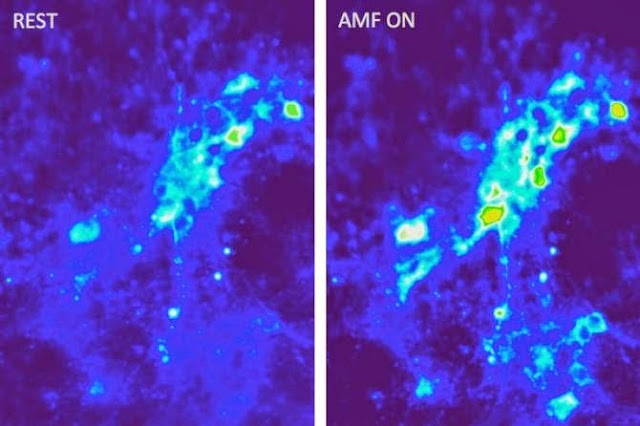 Las imágenes muestran una entrada de iones de calcio en las neuronas como resultado de una excitación magnetotérmica mediante campos magnéticos en presencia de nanopartículas magnéticas. (Imágenes: Cortesía de los investigadores)