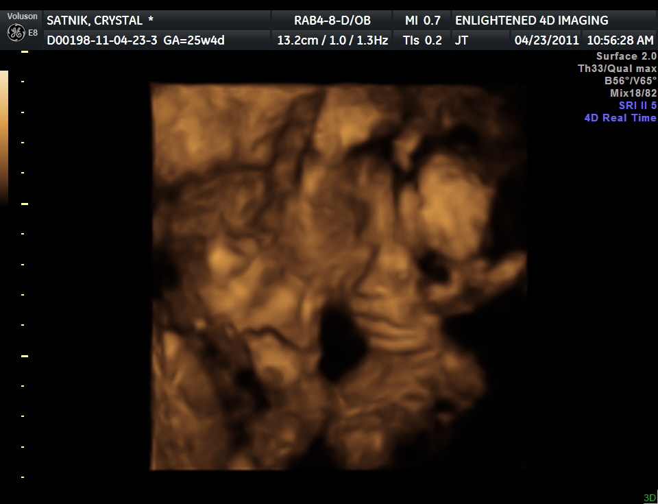 3d ultrasound pictures at 26 weeks. 3D Ultrasound - 26 weeks