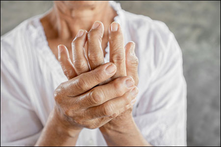 Rheumatoid Arthritis