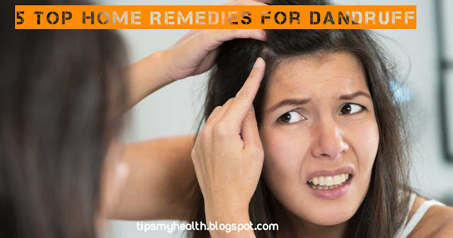 5 Top Home Remedies For Dandruff Hair Care Personal Tips