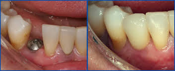 http://precioussmiledental.com/