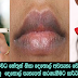 Natural method to whiten dark lips