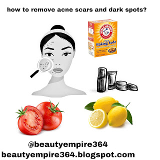 How to remove acne scars?|Beauty empire