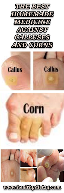 THE BEST HOMEMADE MEDICINE AGAINST CALLUSES AND CORNS