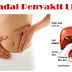 Nama Obat liver alami paling ampuh tanpa efeksamping pas atasi Penyakit Hati thumbnail