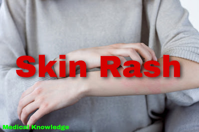 Skin Rash
