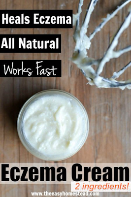 HOMEMADE ECZEMA CREAM