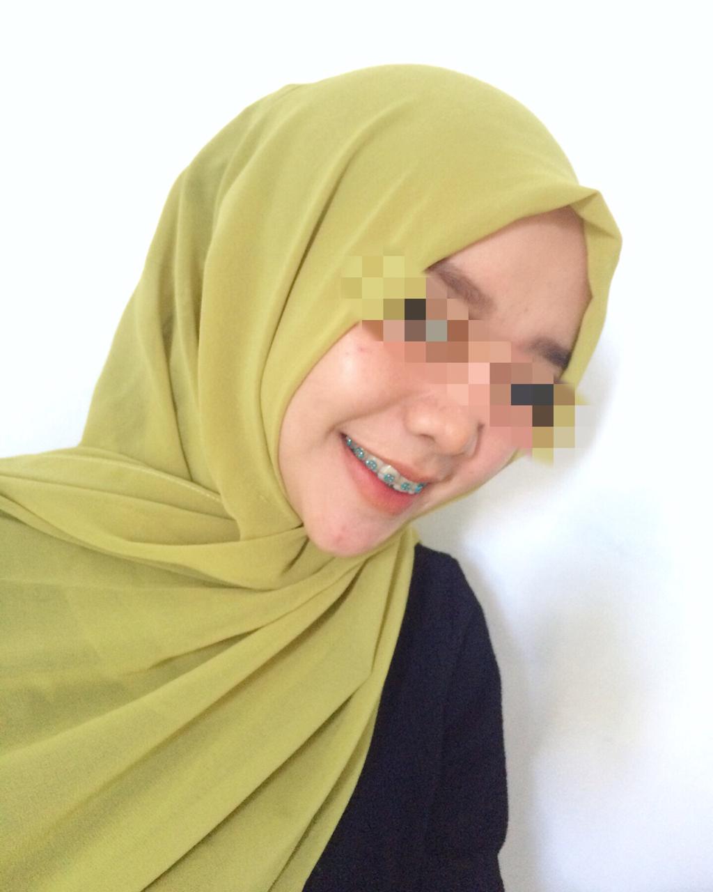 Wajah Glowing dengan MS Glow (Review jujur tentang Ms Glow, baca sampai