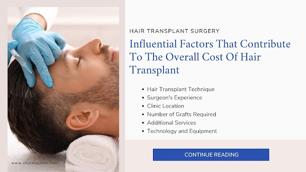 Hair Transplant in Bangalore