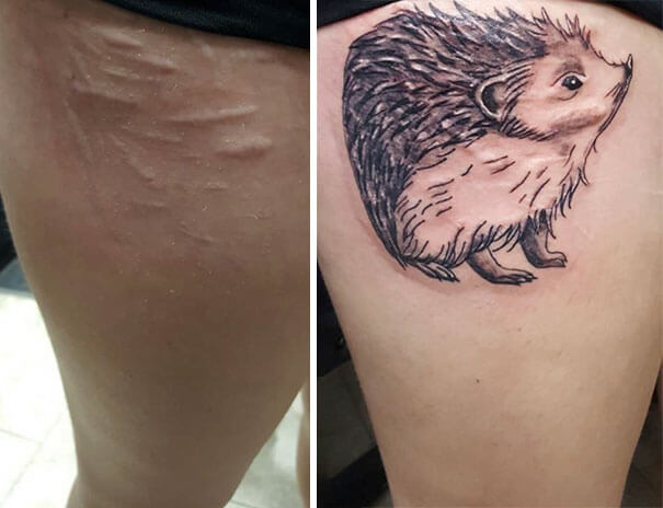 25 Beautiful Tattoos That Transformed Scars Into Artworks