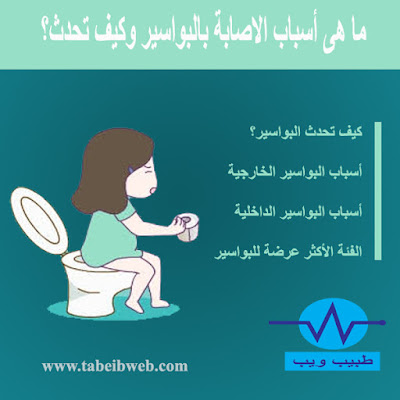 ما هى أسباب الاصابة بالبواسير وكيف تحدث؟ Causes of hemorrhoids