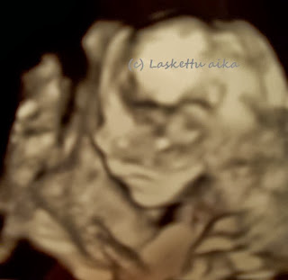 sikiö vauva ultrakuva ultraääni rakenneultra