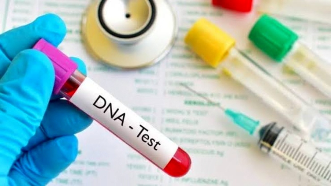 With a simple swab of your cheek or a sample of your saliva, dna test kits have helped deepen our understanding of ancestors