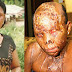 Married Man Jailed 10 Years For Bathing Lover With Acid (Warning: Graphic Photo)