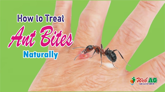 How to Treat Ant Bites Naturally