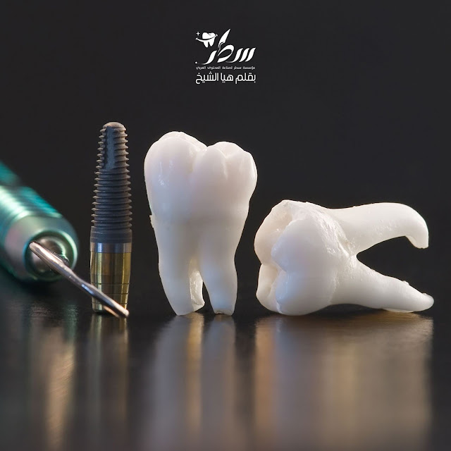 هل تعلم أنّ خلع أحد الأسنان يؤثر على الأسنان المجاورة- تصميم الصورة رزان الحموي
