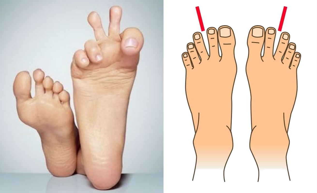 The Shape Of Your Feet Reveals Very Special Things About Your Personality