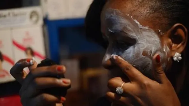 Skin whitening products remain popular in Cameroon despite risks