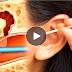 Ear Cleaning – You Will Never Use Cotton Swabs Again After Watching This Video!