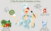 Top 10 Tips for Acne