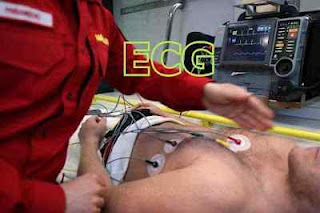 ECG-Test